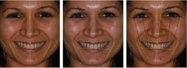 Dental Facial Analysis