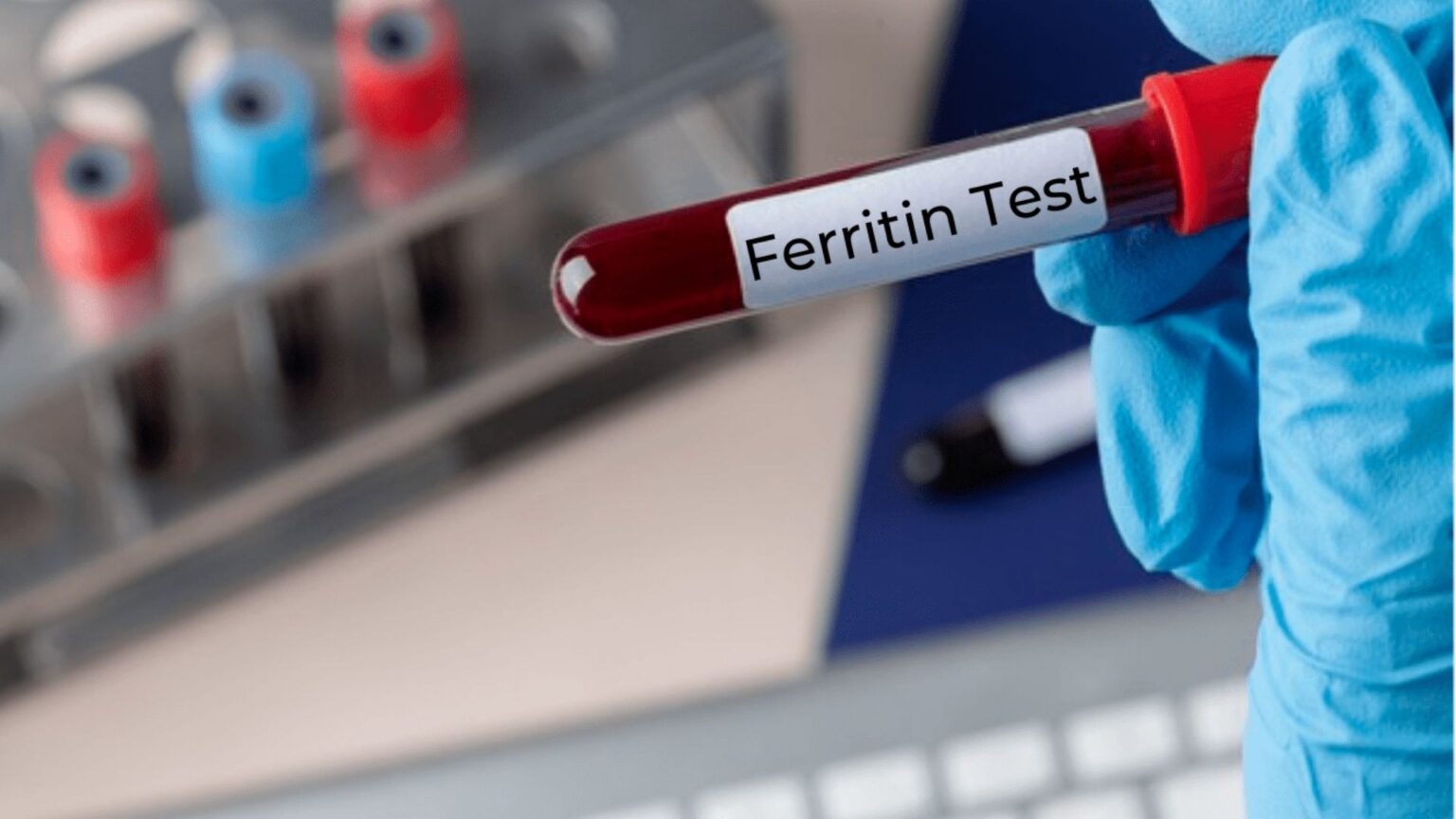 Ferritin Test Preparation, Results and Levels 'Monomousumi'