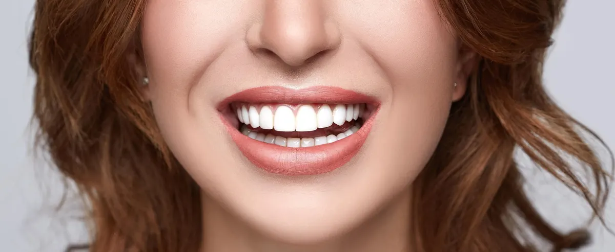How Porcelain Veneers Create That Magazine-Cover Smile