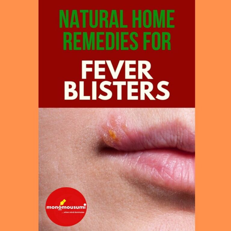 Natural Home Remedies to Treat a Fever Blister