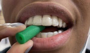 invisalign-chewies